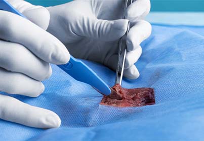 Minor Surgery 3