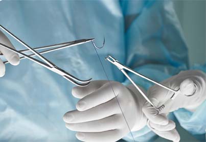 Minor Surgery 5