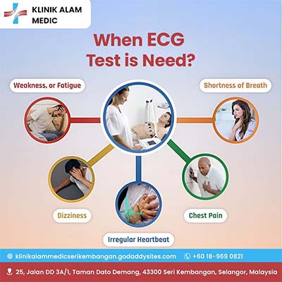 ECG